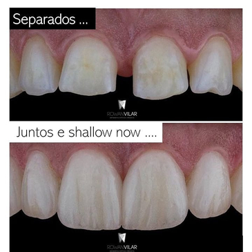 Slider image (3) Dr. Rowan Vilar - Best Dentist in Rio de Janeiro